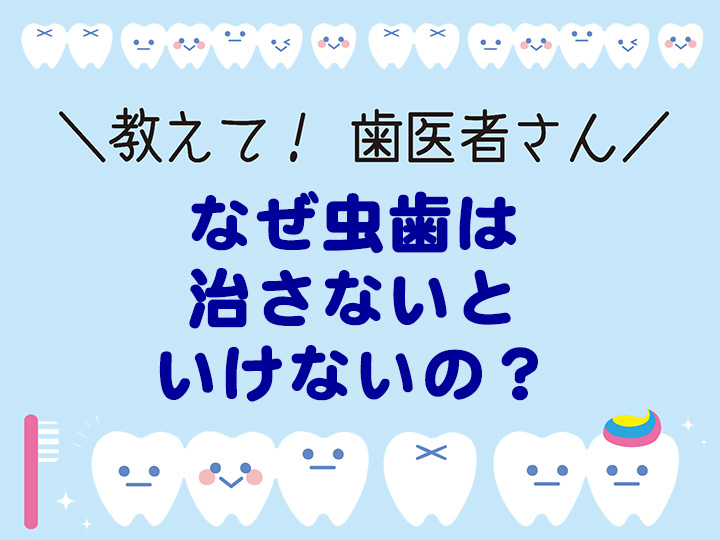 なぜ虫歯は治さないといけないの？